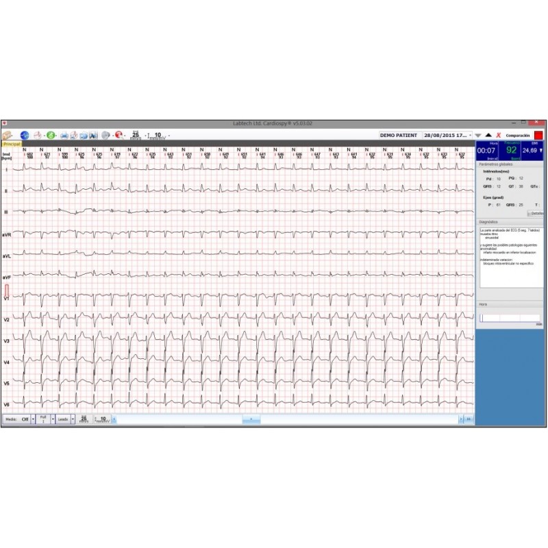 Electrocardiógrafo de Reposo de Altas Prestaciones ECG 12R pantalla software